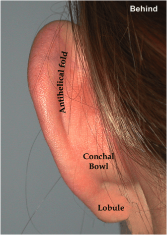 Otoplasty (ear pinning) | Dr. Jason Roth (drjasonroth.com.au)