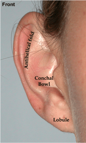 Otoplasty (ear pinning) | Dr. Jason Roth (drjasonroth.com.au)