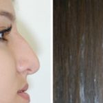 CO-Before-and-after-618x227